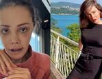Y&uuml;z nakli sonrası kaşında sa&ccedil; &ccedil;ıktı! Didem Ceran'dan şaşırtan paylaşım