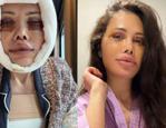 Kore'de y&uuml;z nakli ge&ccedil;irmişti! Didem Ceran'ın y&uuml;z&uuml; ile ilgili sorduğu soru g&uuml;ndem oldu