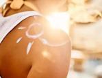Kavurucu sıcaklara dikkat: G&uuml;neş yanıklarında g&ouml;r&uuml;nmeyen &ouml;l&uuml;me tehlikesi