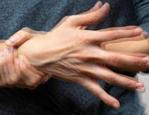 Parkinson tedavisinde sevindiren haber: Ameliyatsız ayakta uygulanan yeni y&ouml;ntem tanıtıldı