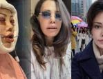 Kore'de y&uuml;z nakli sonrası &ouml;l&uuml;m dilekleriyle karşılaştı: Didem Ceran isyan etti