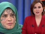 Y&uuml;z&uuml;ndeki d&ouml;vmelerle g&uuml;ndem olmuştu! Nazan &Uuml;nal'dan sunucu Didem Arslan Yılmaz'a şok su&ccedil;lama