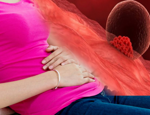Hamilelikte İmplantasyon kanaması nedir? Yerleşme kanaması ile adet kanaması nasıl ayırt edilir