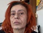 Yıldız Tilbe ilk kez hastalığını açıkladı! Doktorunun yasağı şaşırttı
