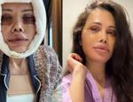 Kore'de y&uuml;z nakli ge&ccedil;irmişti! Didem Ceran'ın y&uuml;z&uuml; ile ilgili sorduğu soru g&uuml;ndem oldu