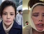 Didem Ceran ikinci kez y&uuml;z ameliyatı oldu! G&ouml;zyaşlarıyla isyan etti