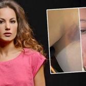 Yıldız Asyalı, 7 aylık eşi tarafından darp edildiğini a&ccedil;ıkladı! A&ccedil;ıklamalar peş peşe geldi