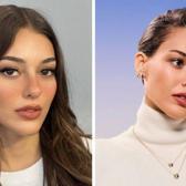 Dilan &Ccedil;i&ccedil;ek Deniz'in y&uuml;z&uuml;ndeki değişim olay oldu! G&ouml;renler tanıyamadı