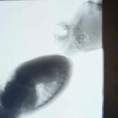 Basit bir &ouml;ks&uuml;r&uuml;n demeyin! &Ccedil;ocuklardaki riskli solunum belirtileri hayati alarm olabilir