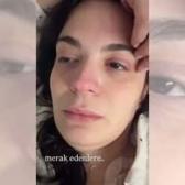 7. kez ameliyat olmuştu! Aslı Bekiroğlu k&ouml;t&uuml; haberi g&ouml;zyaşları i&ccedil;erisinde verdi