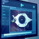 G&ouml;zl&uuml;k ve lens tarih oluyor: Lazerle kalıcı &ccedil;&ouml;z&uuml;m