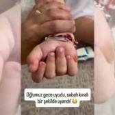 Sosyal medyada g&uuml;ndem oldu! &Ccedil;ocuğunun el ve ayaklarındaki renk değişiminin nedeni şaşırttı