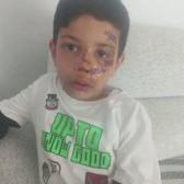 7 yaşındaki Emir&rsquo;in &ouml;n d&ouml;rt dişi yerinden &ccedil;ıktı! Doktorlardan başarılı m&uuml;dahale