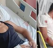 14 yaşındaki Kenan "ne bakıyorsun" kavgasında ağır yaralandı