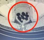 Kayseri'de uyuşturucu operasyonu: Midesinden çıkan şoke etti