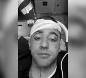 Taksici ile motosiklet sürücüsü kavgasında kan aktı