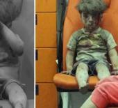 Dünya gündemine oturmuştu! Ümran bebeğin son hali ortaya çıktı!