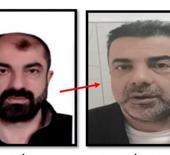 Y&uuml;z&uuml;n&uuml; değiştiren firari zanlı 7 yıl sonra yakalandı
