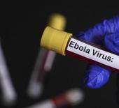 Ebola alarmında "T&uuml;rkiye" sorusu: Şu anda bir risk s&ouml;z konusu değil!