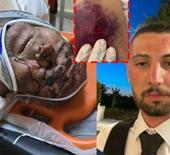 &Ccedil;anakkale&rsquo;de akılalmaz olay! 150 bardak &ccedil;ay i&ccedil;in &ouml;ld&uuml;resiye d&ouml;v&uuml;ld&uuml;