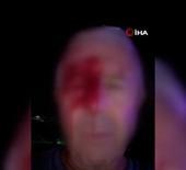 Haber yaparken saldırıya uğrayan muhabir yaralandı