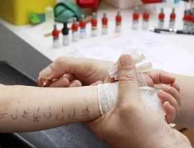 Çocuklarda alerji testi nasıl yapılır? Deri prick testi nedir?