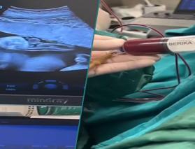 Anne karnındaki bebeğe kan nakli yapıldı