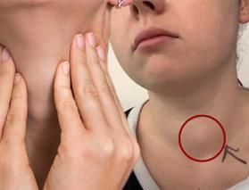 Yıllarca şikayetleri g&ouml;rmezden gelindi! Tiroid kanseri olduğunu arkadaşları fark etti