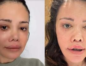 Y&uuml;z nakli olan Didem Ceran'ın gen&ccedil;lik sırrı yumurta &ccedil;ıktı!