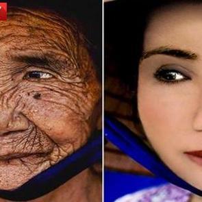 100 yaşındaki kadın 20 yaşına geri getirildi