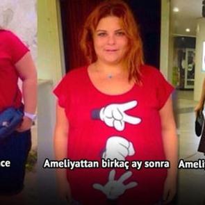 Pelin &Ouml;zt&uuml;rk'&uuml;n son hali g&ouml;renleri şoke etti! &Uuml;nl&uuml; oyuncu eridi