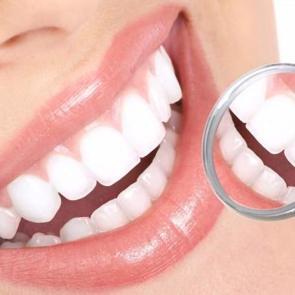 Al&uuml;minyum folyo ile diş beyazlatma