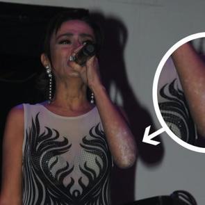 Yıldız Tilbe'nin &uuml;zen g&ouml;r&uuml;nt&uuml;s&uuml;! T&uuml;m kolları...