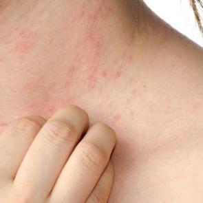 &Ccedil;ay ağacı yağının faydaları nelerdir?