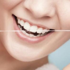 Ramazan Bayramı'nda diş ipini yanınızdan ayırmayın