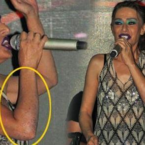 Yıldız Tilbe'nin hayranlarını &uuml;zen g&ouml;r&uuml;nt&uuml;s&uuml;! T&uuml;m kolları...