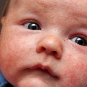 Bebeğinizin cildini havasız bırakmayın!