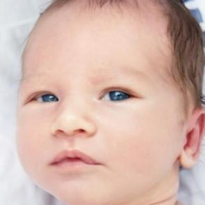 Bebeklerde arpacık nasıl ge&ccedil;er?