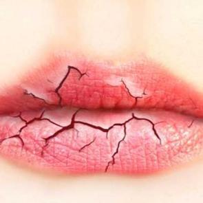 Dudakları yumuşatan etkili maske tarifi