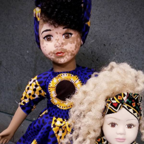 Bu bebekler diğerlerinden &ccedil;ok farklı!