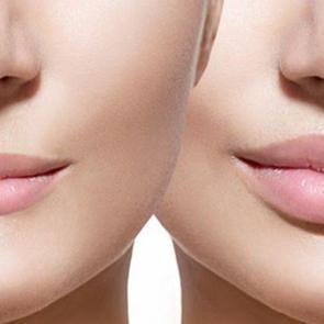 Dudakları kalın g&ouml;stermenin yolları