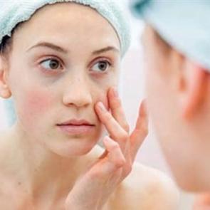 G&ouml;zaltı morluklarından kurtulmanın kolay yolları