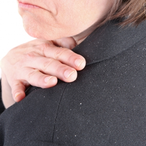 Kepeğe karşı bitkisel &ccedil;&ouml;z&uuml;m... Kepek neden olur?