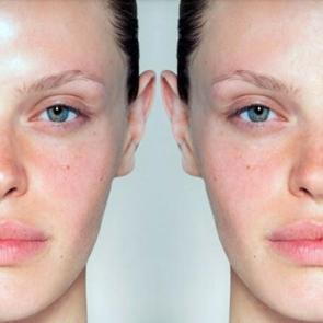 Karma ciltler i&ccedil;in ev yapımı maskeler