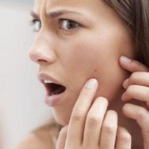 Siyah noktalar i&ccedil;in doğal maske