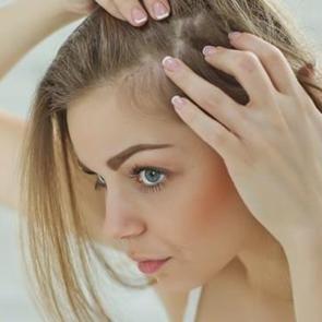 Karbonat sa&ccedil; kepeğini ge&ccedil;irir mi?