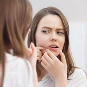 Y&uuml;zde &ccedil;ıkan sivilcelerin nedenleri nelerdir?