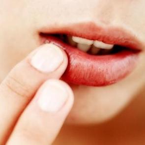 Dudak &ccedil;atlamasına ne iyi gelir?