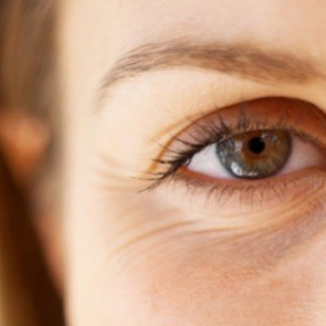 G&ouml;z &ccedil;evresindeki kırışıklıklardan kurtulmak i&ccedil;in ne yapılmalı?