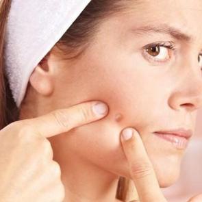 Sivilceli ciltler i&ccedil;in doğal bakım &ouml;nerileri